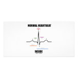 Normal Heartbeat Inside (ECG EKG) Custom Photo Card