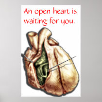 Open Heart