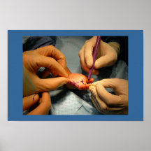 Pediatric Hand Surgery Print
