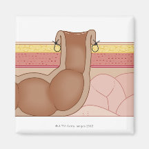 Permanent Colostomy Refrigerator Magnet