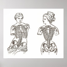 Physical Impact of Wearing Corsets Medical Print