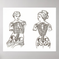Physical Impact of Wearing Corsets Medical Print