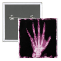 Pink X-ray Skeleton Hand
