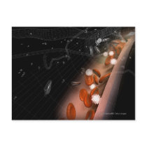 Plaque in the arteries post cards