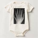 Polydactyly, Six Fingered Hand, X-Ray, rarity! t-shirts