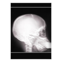 Prescription Invite w/Foot In Mouth X-ray