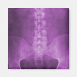 Purple Digital X-Ray Art Magnet