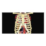 Ribs Veins Enlarged Heart photo cards