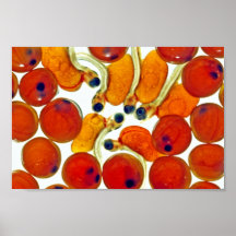 Salmon Eggs and Fry Print