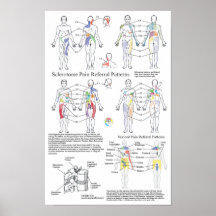 Sclerotome Visceral Pain Referral Chart Poster