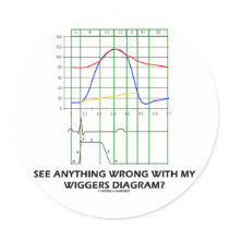 See Anything Wrong With My Wiggers Diagram?