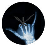 Shaka Sign X-Ray (Hang Loose)