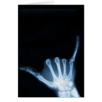 Shaka Sign X-Ray (Hang Loose) Cards