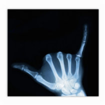 Shaka Sign X-Ray (Hang Loose) Photo Sculpture