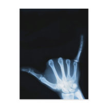 Shaka Sign X-Ray (Hang Loose) Post Cards