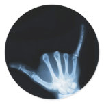 Shaka Sign X-Ray (Hang Loose) Sticker
