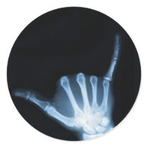Shaka Sign X-Ray (Hang Loose) Sticker