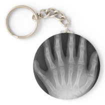Six Fingered Hand, Medical Rarity, X-Ray Keychains