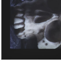 Skull Canvas Prints