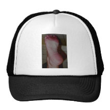 SOLE SHOT HAT