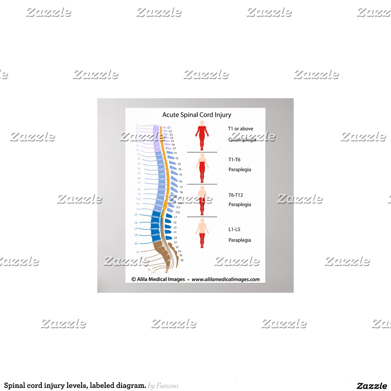 spinal cord injury diagram spinal cord injury levels labelled diagram zazzle spinal cord injury diagram spinal cord injury levels labelled diagram zazzle