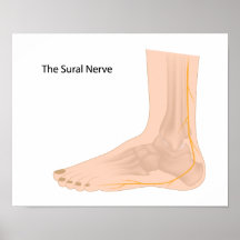 Sural nerve  Poster
