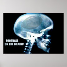 Tête du football (rayon X) Posters