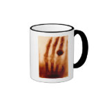 The First X-Ray, 1901, Photograph Coffee Mugs