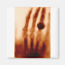 The First X-Ray, 1901, Photograph Magnets