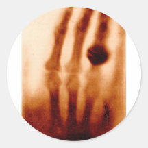 The First X-Ray, 1901, Photograph Stickers