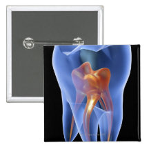 Tooth, transparent cross section of a molar pinback button
