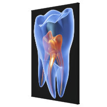 Tooth, transparent cross section of a molar stretched canvas print