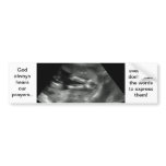 Ultrasound of a baby holding his hands in prayer! bumper stickers