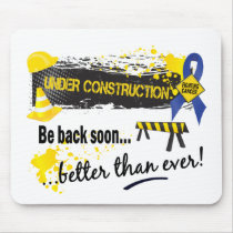 Under Construction Rectal Cancer