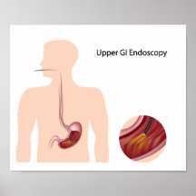 Upper GI endoscopy Poster