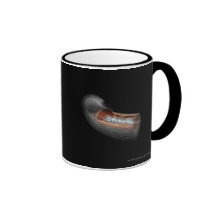 View of an angioplaty balloon in an artery coffee mug