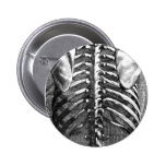 Vintage drawing of a spine and ribcage