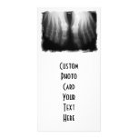 X-Ray Feet Human Skeleton Bones Black & White Custom Photo Card