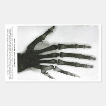 X-Ray Hand with Extra Finger Sticker