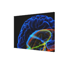 X-ray image of the brain gallery wrap canvas
