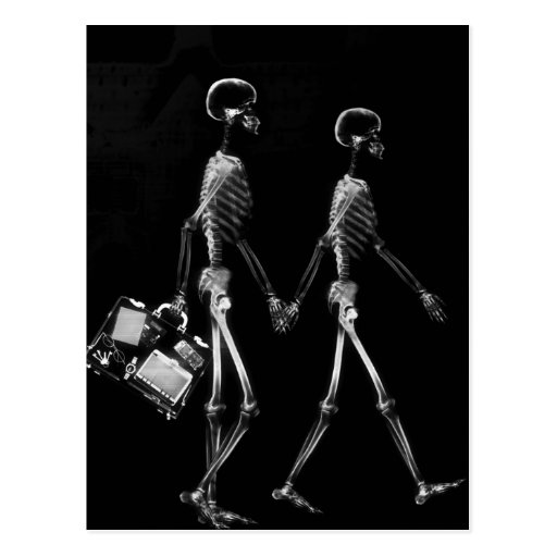 X-Ray Skeleton Couple Travelling Black White Post Cards