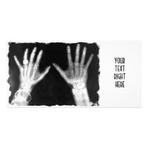X-Ray Skeleton Hands & Jewellery - B&W