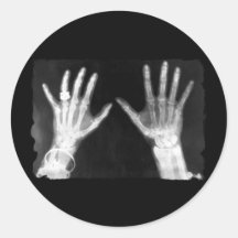 X-Ray Skeleton Hands & Jewellery - B&W Round Stickers