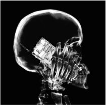 X-RAY SKELETON ON CELL PHONE BLACK & WHITE