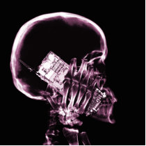 X-RAY SKELETON ON PHONE - PINK