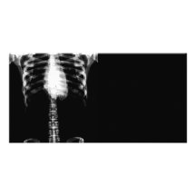 X-RAY SKELETON TORSO RIBS - B&W PERSONALIZED PHOTO CARD