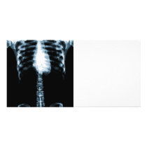 X-RAY SKELETON TORSO RIBS - BLUE