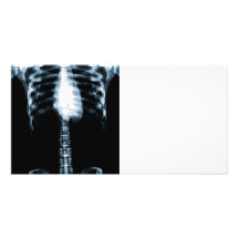 X-RAY SKELETON TORSO RIBS - BLUE PHOTO GREETING CARD