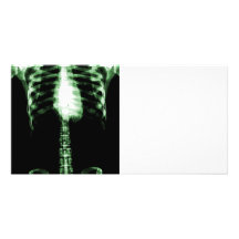 X-RAY SKELETON TORSO RIBS - GREEN CUSTOMIZED PHOTO CARD