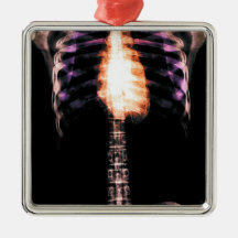 X-RAY SKELETON TORSO RIBS - ORIGINAL ORNAMENTS